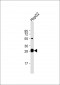 DCI Antibody (C-term)