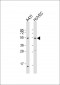 EFEMP1 Antibody (N-term)