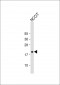 HMGA1 Antibody (C-term)