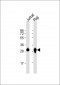 ANP32A Antibody (C-term)
