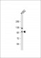 FOXK1 Antibody (C-term)