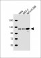 PPP1R13L Antibody (N-Term)