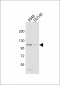 SEMA4B Antibody (C-term)