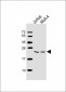 MGMT Antibody