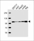 SLC22A2 Antibody (N-term)