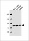 GARS Antibody (C-term)