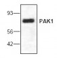 PAK1 Antibody