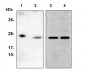 BCMA (TNFRSF17) Antibody