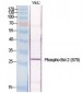 Phospho-Bcl-2 (Ser70) Antibody