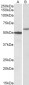 Goat Anti-CD47 Antibody (internal region (near C terminus))