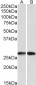 Goat Anti-NNMT Antibody (N Terminus)