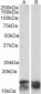 Goat Anti-CD3-ZETA / CD247 Antibody (internal region)