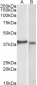 Goat Anti-CX3CR1 Antibody (internal region (near N terminus))