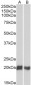 Goat Anti-CD3D Antibody (internal region)