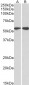 Goat Anti-Vimentin Antibody (C Terminus)