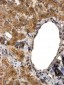 Goat Anti-ALDH3A2 Antibody (internal region)