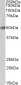 Goat Anti-BPI Antibody (internal region)