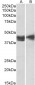 Goat Anti-IL3RA / CD123 Antibody (internal region)