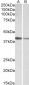 Goat Anti-cardiac troponin T Antibody (internal region)