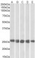 Goat Anti-CSNK2B Antibody (internal region)