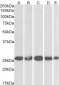 Goat Anti-CSNK2B Antibody (internal region)