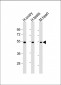 VEGF3 Antibody