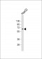 AFP Antibody (N-term)