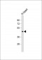 PDK2 Antibody