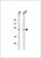 TGFB2 Antibody