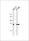 Glucagon Antibody