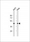 ACTA1 Antibody