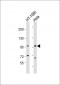 TFRC Antibody