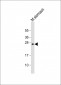 RAB27B Antibody