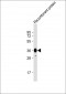 MYO18B Antibody