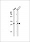 RAB20 Antibody