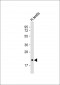 CD81 Antibody