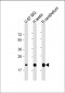 CD81 Antibody