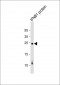 IFNB1 Antibody