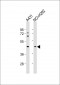 SERPINB3 Antibody