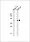 BCAT1 Antibody (Center)