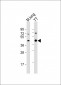 NKX2-1 Antibody (N-term)