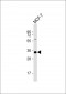 STUB1 Antibody (C-term)