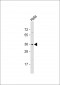 OR52E2 Antibody (C-term)