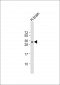 SOX15 Antibody (Center)