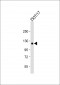 COL2A1 Antibody (C-term)