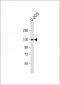 DNMT3A Antibody (Center R478)