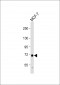 PDZK1 Antibody (Center)