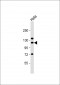 SND1 Antibody (Center)