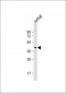 DNMT3L Antibody (C-term)