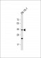 OR2L8 Antibody (C-term)